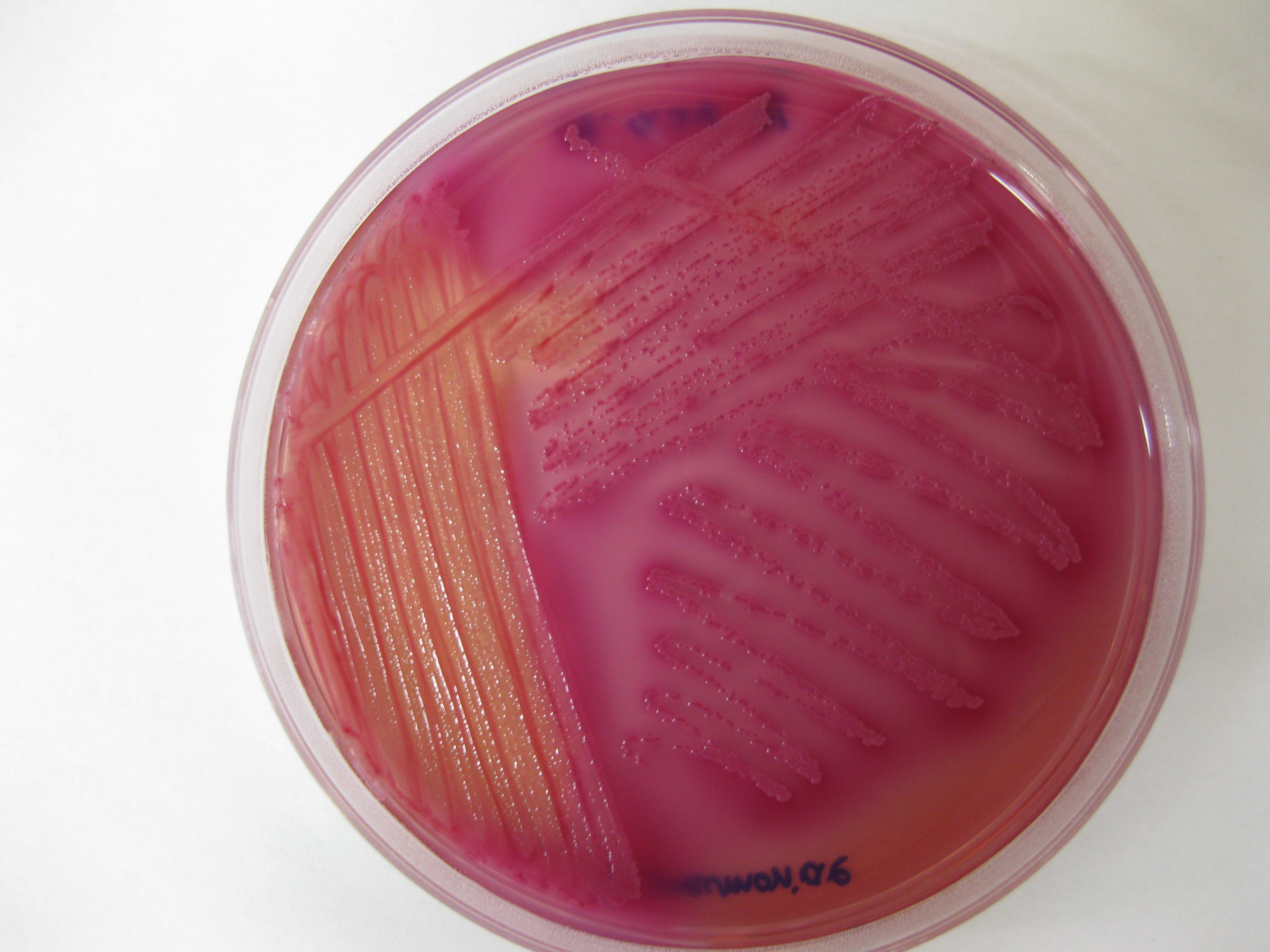 Klebsiella 2_2